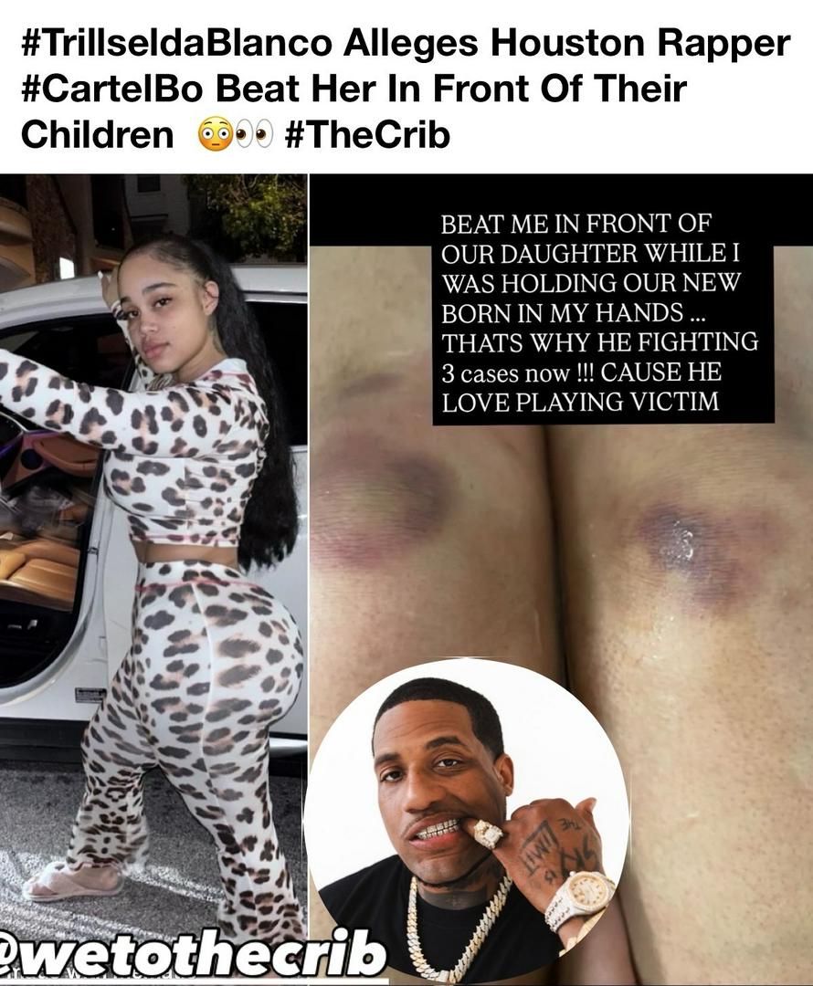 IG Model Abused By Rapper Boyfriend 