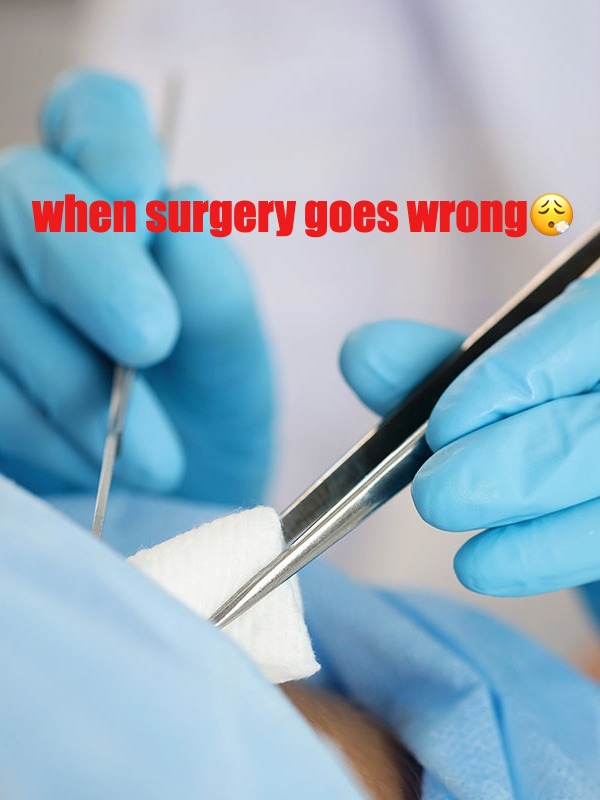 they "removed" my appendix... EXCEPT THEY DIDN'T!