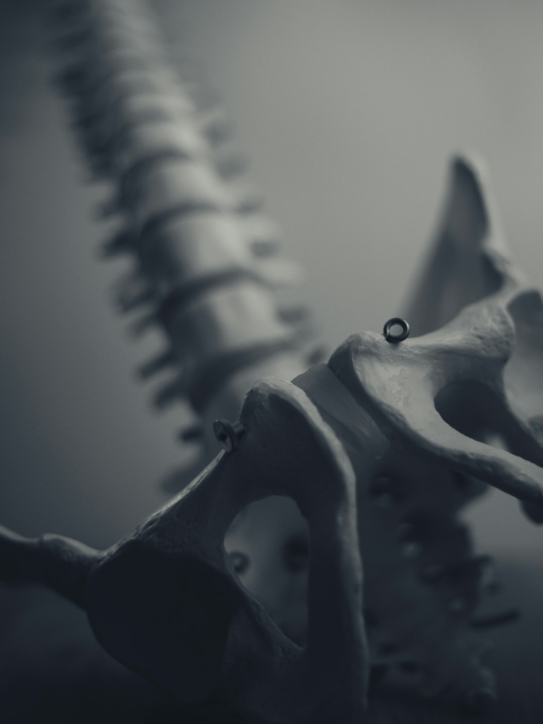 Chiropractor's twist ends in massive payout