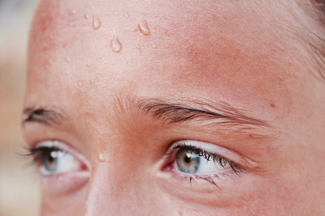 Why Does My Face Sweat So Much?!