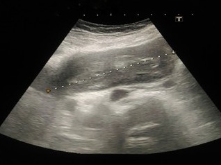 How I REALLY Found Out My Baby’s Gender!