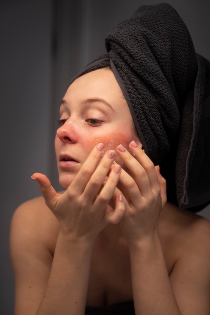 Rosacea Diagnosis Has Me Rethinking My Skincare—What Should I Try Next?
