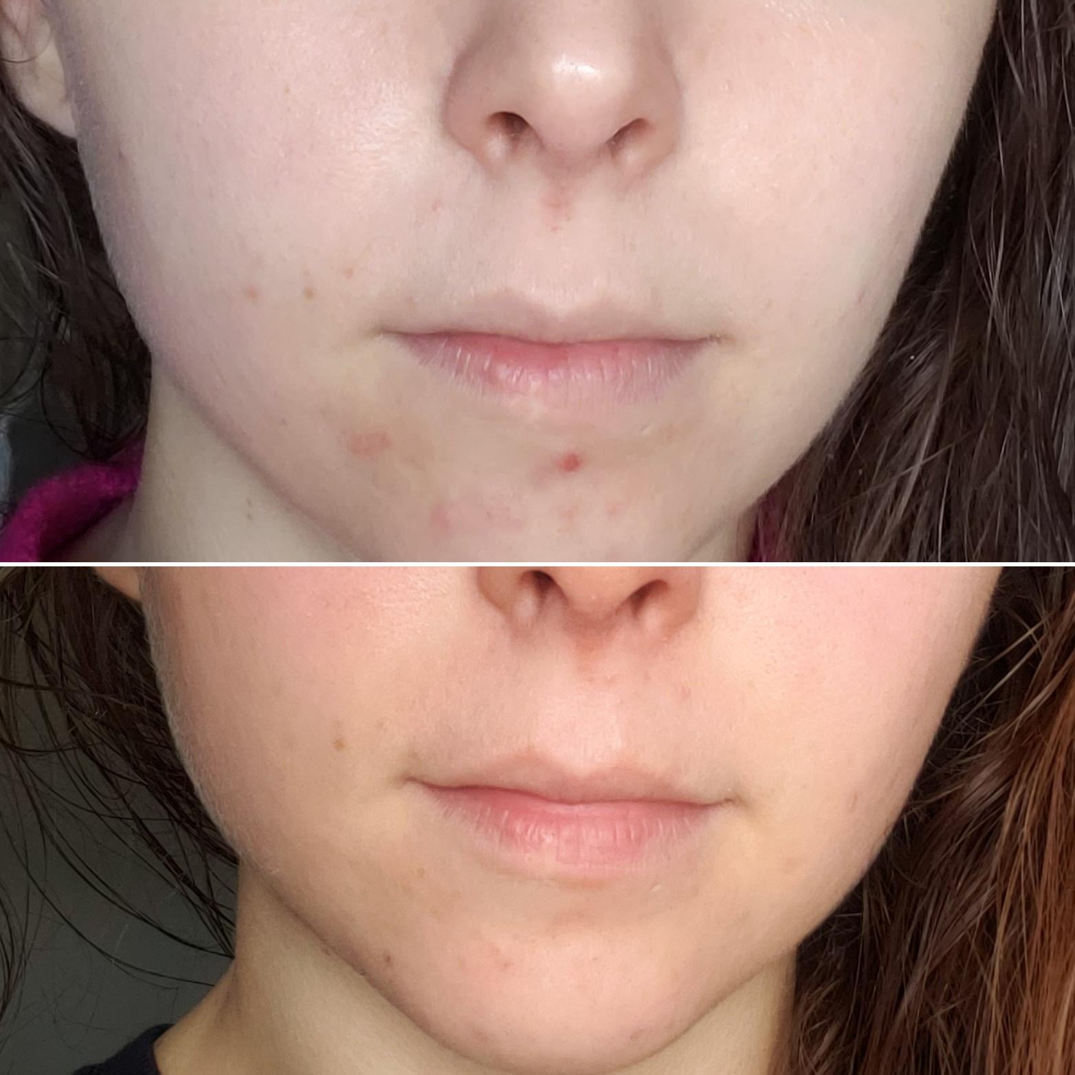 Would You Recognize Yourself in Your Old Skin Care Photos?