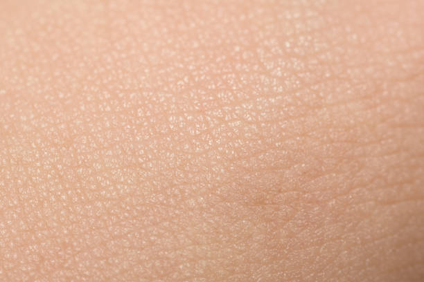 From Breakouts to Barefaced: My Hormonal Acne Journey