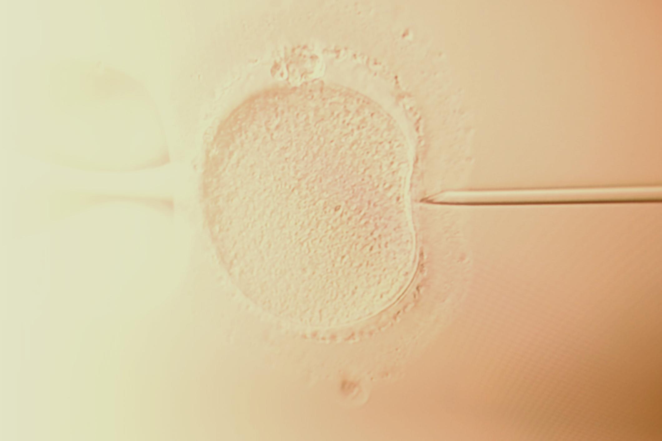 Giving Yourself Ovidrel? Read This First