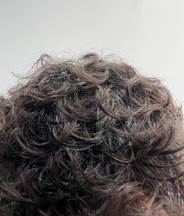Baking Soda on Hair: Miracle Cleanse or Recipe for Regret?