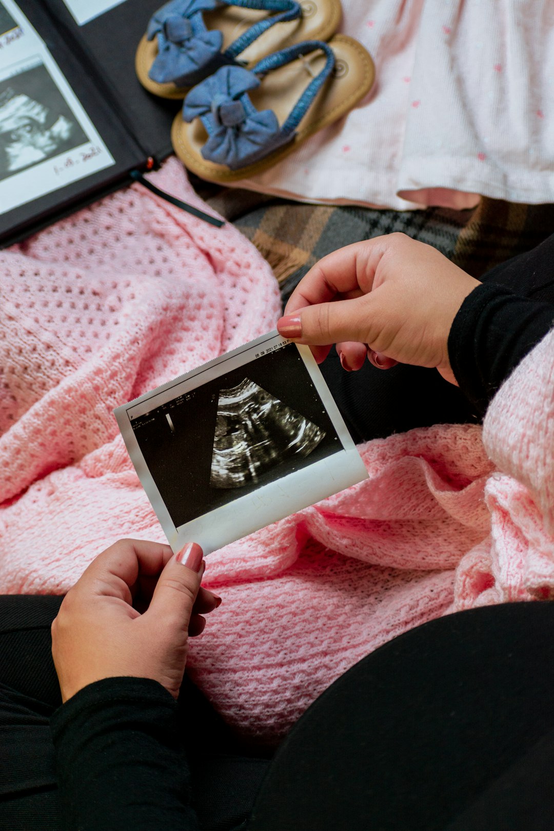 Facing the Unexpected: My Journey as a 15-Year-Old Mom