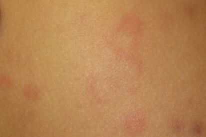 Ever Dealt With Random Hives?