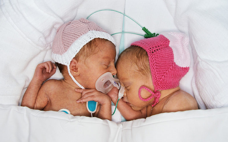 Our Journey With Twins Born at 26 Weeks: Tiny Miracles, Big Lessons
