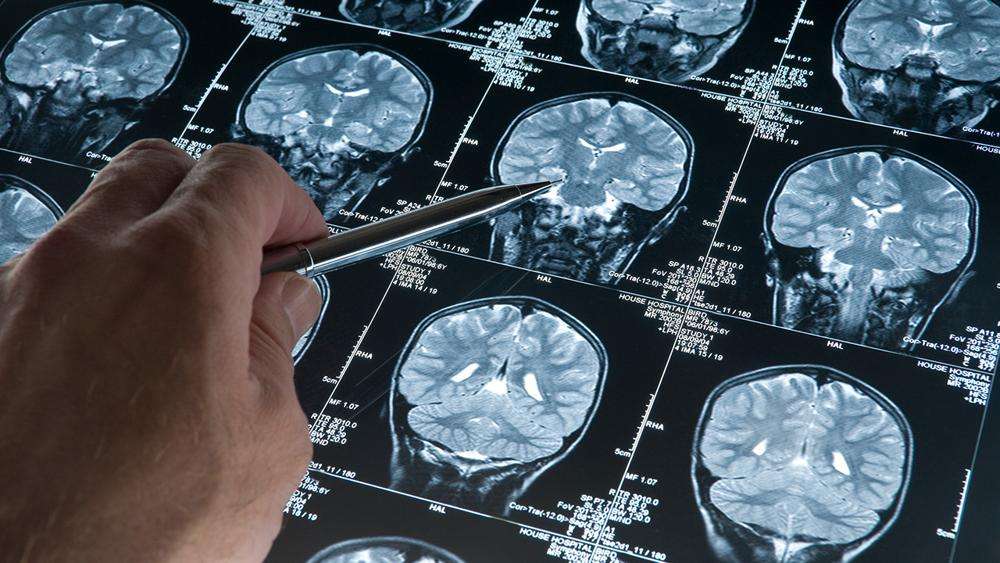 Is Alzheimer’s Research Built on Lies?