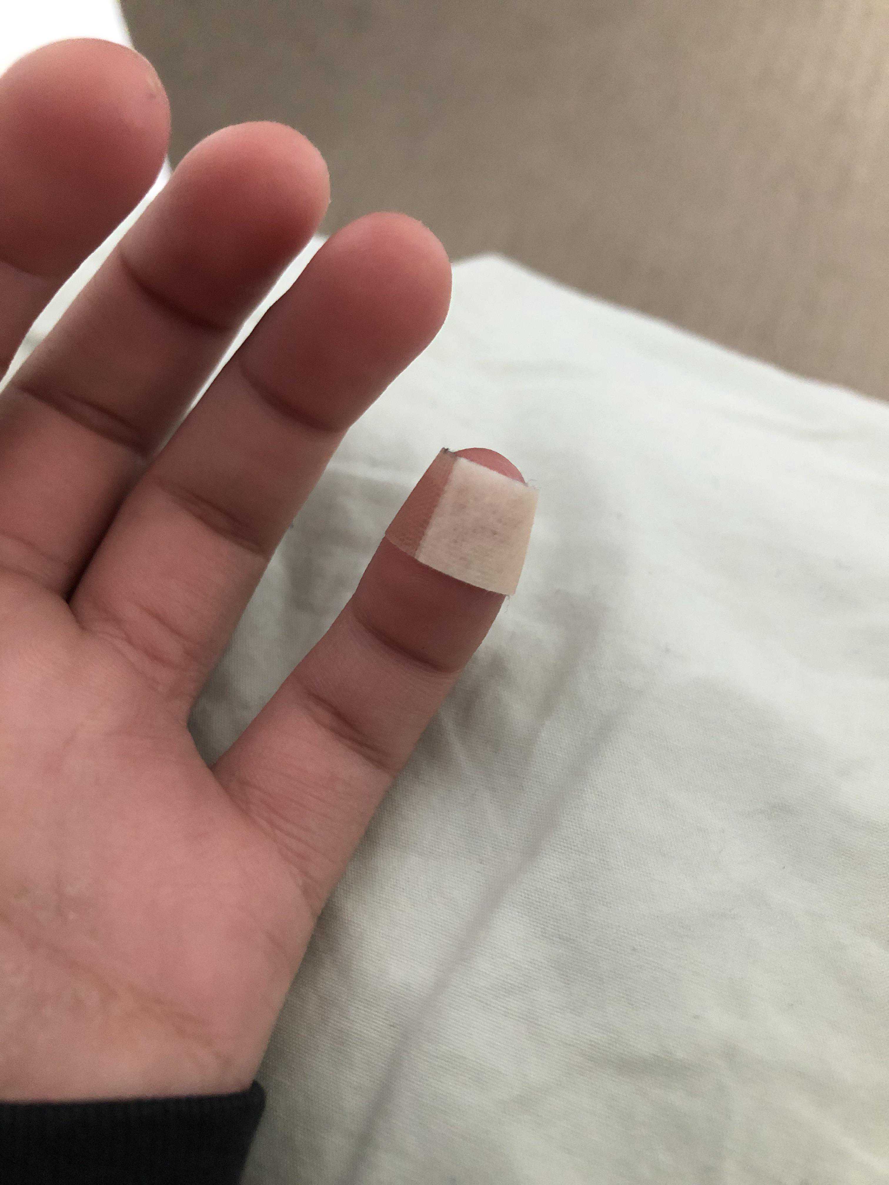 When Should I See a Doc for a Cut?