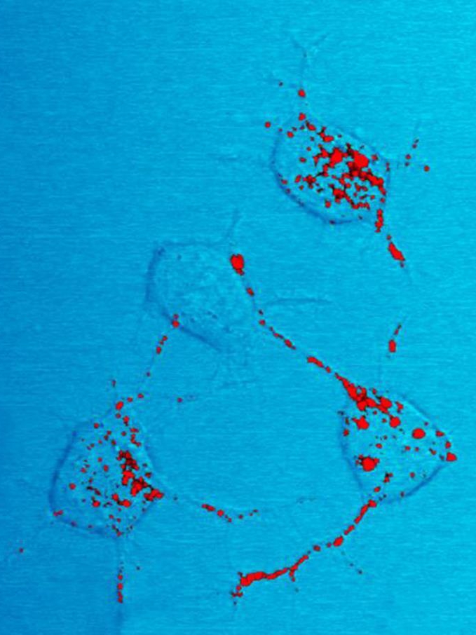A 50-Year-Old Injection Nightmare
