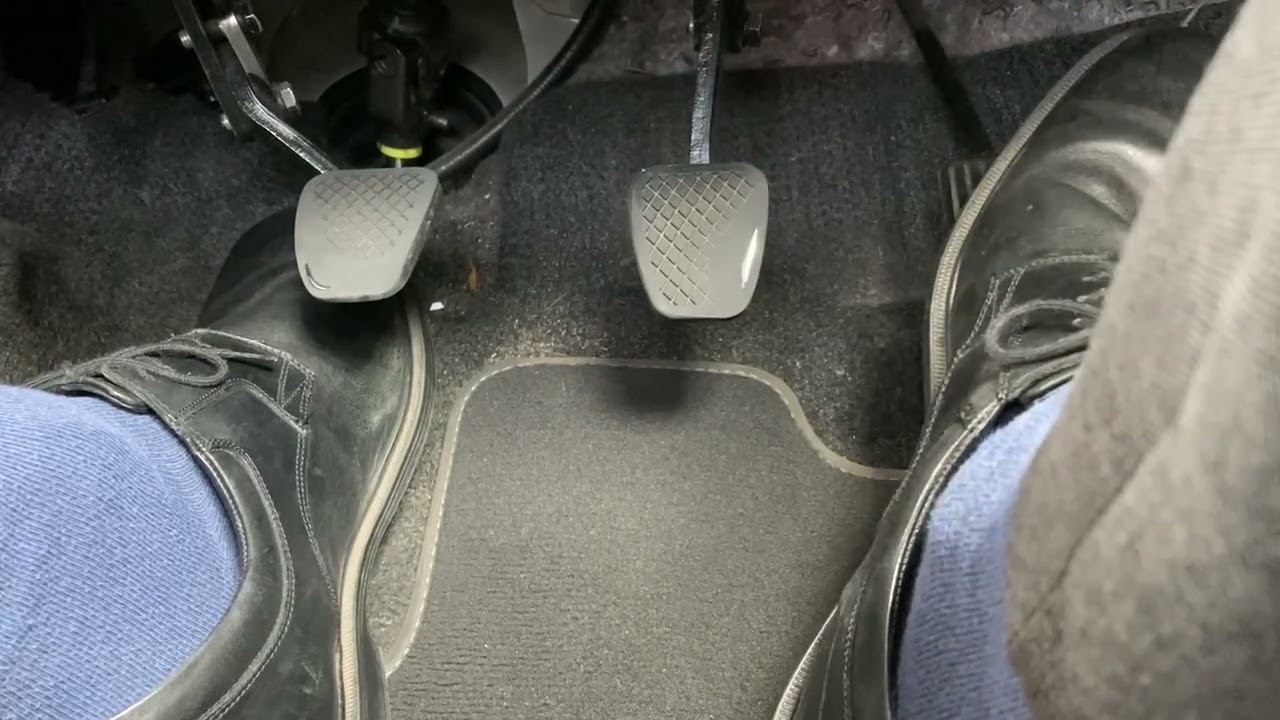 If You Had to Lose a Pedal, Which Would It Be?