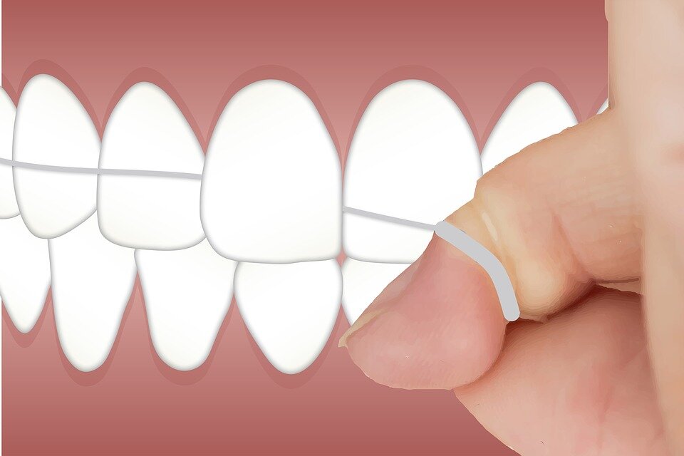 Flossing Like a Pro: The Chic Secret to a Confident Smile