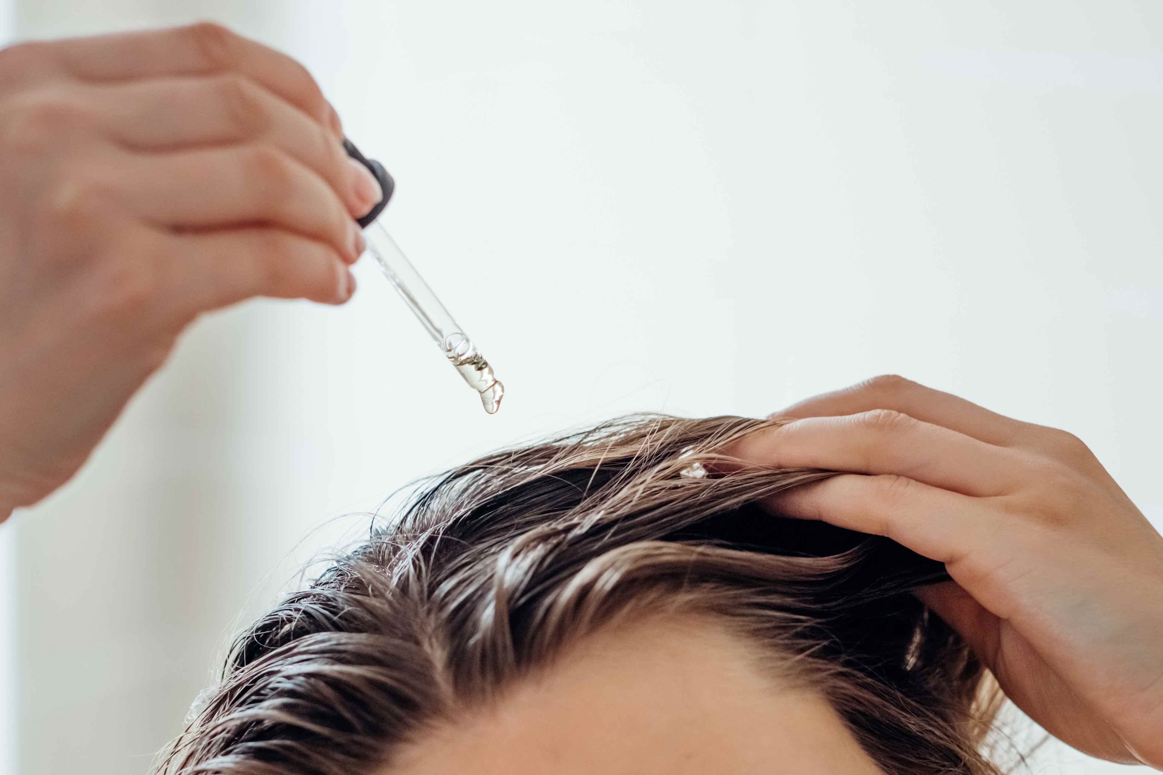 Itchy Scalp After Hair Dye? Here’s How I Soothe & Prevent the Burn!