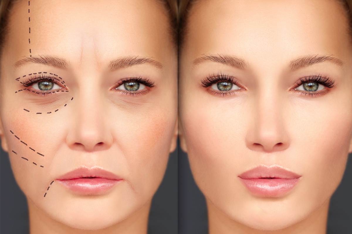 Pillow Face Panic? How to Avoid Overfilled Cheeks & Keep Your Glow Natural