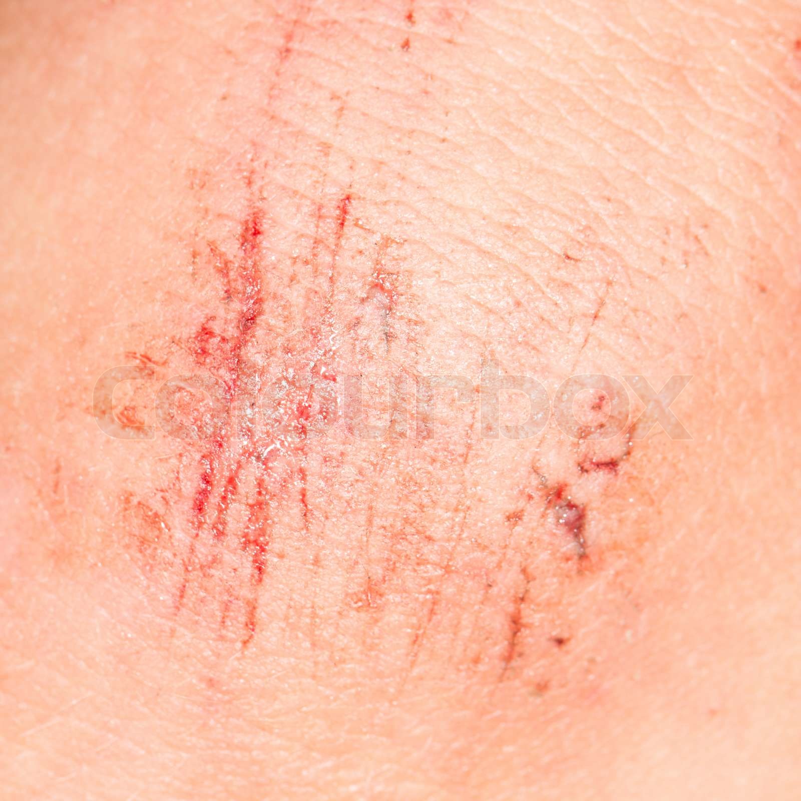 Your Face, Your Story: Healing Wounds Without Lasting Scars