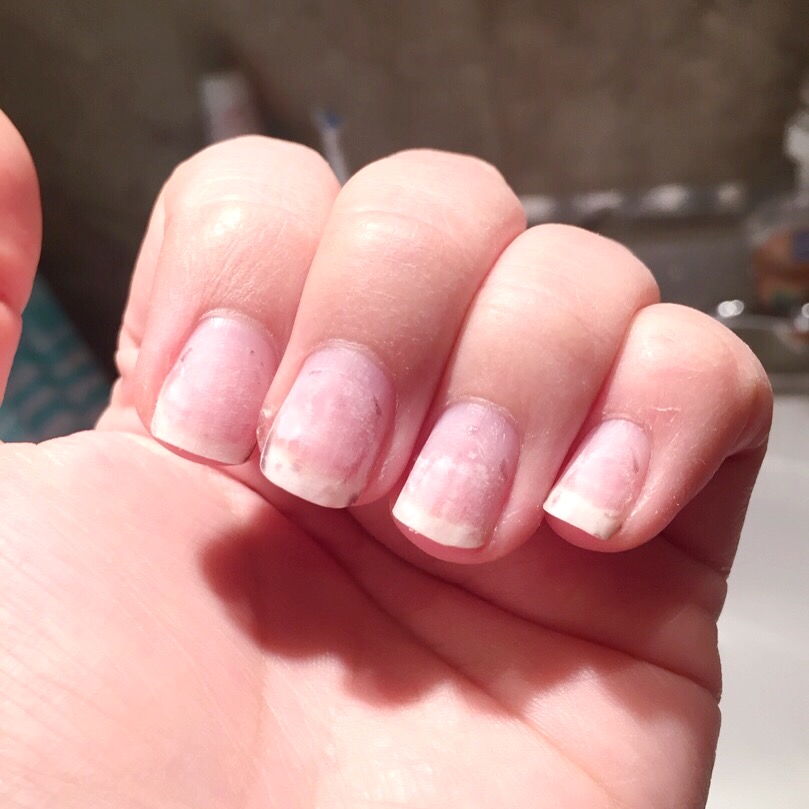 My Gel Manicure Hangover: How I Brought My Nails Back to Life