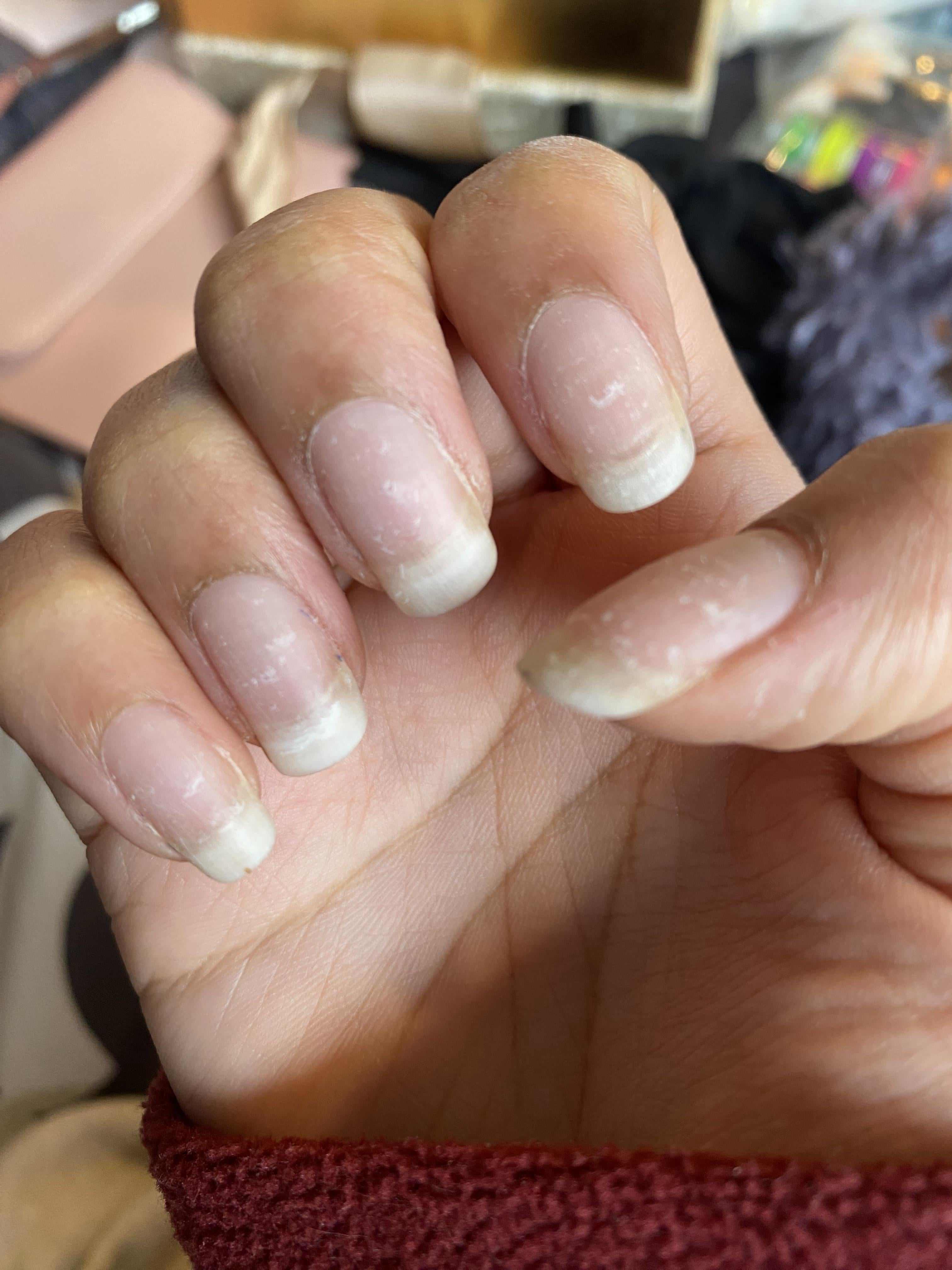 My Gel Manicure Hangover: How I Brought My Nails Back to Life
