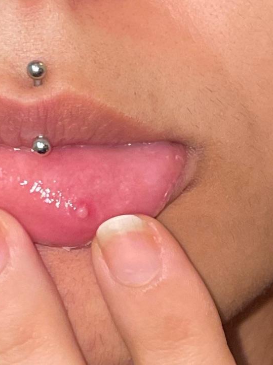 Labret Piercings: The Lip Statement That’s Worth the Hype (and the Swelling)