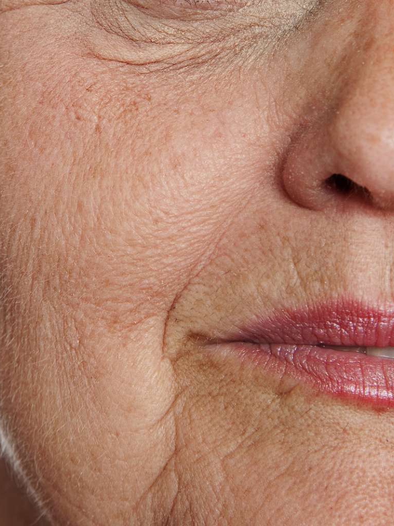 Is My Skin Aging or Just Changing? Turning 58 Has Me Wondering!