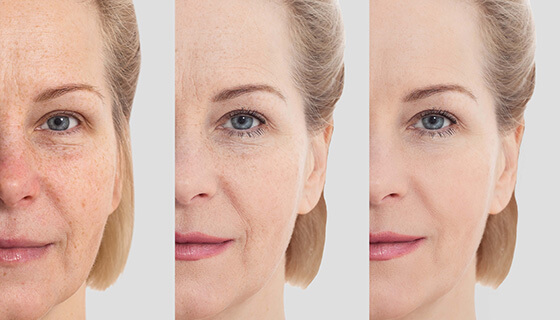 Is It Just Me, or Does Aging Feel Like a Beauty Competition We Never Signed Up For?