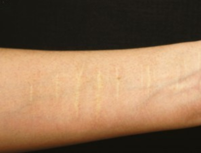 I Still Hide My Scars, Even From Myself