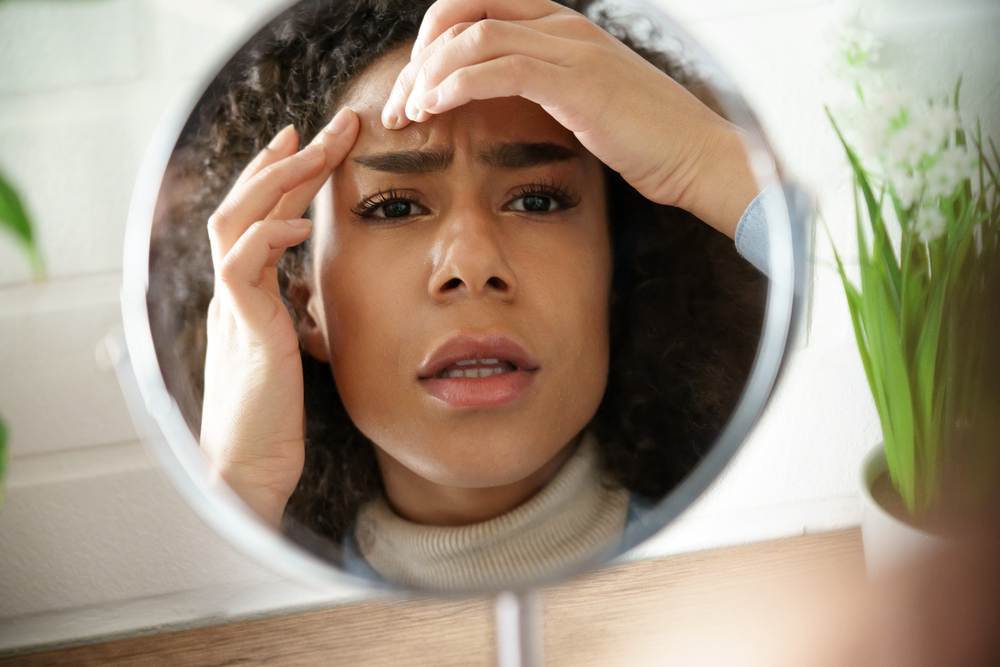 Breakouts Got You Down? Here’s What Helped Me Bounce Back!