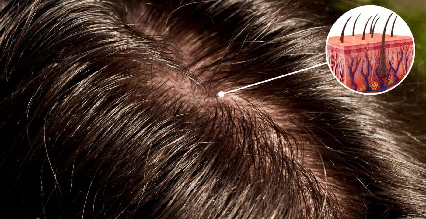 Flat, Greasy Hair? Here’s How I Bounced Back from Over-Conditioning