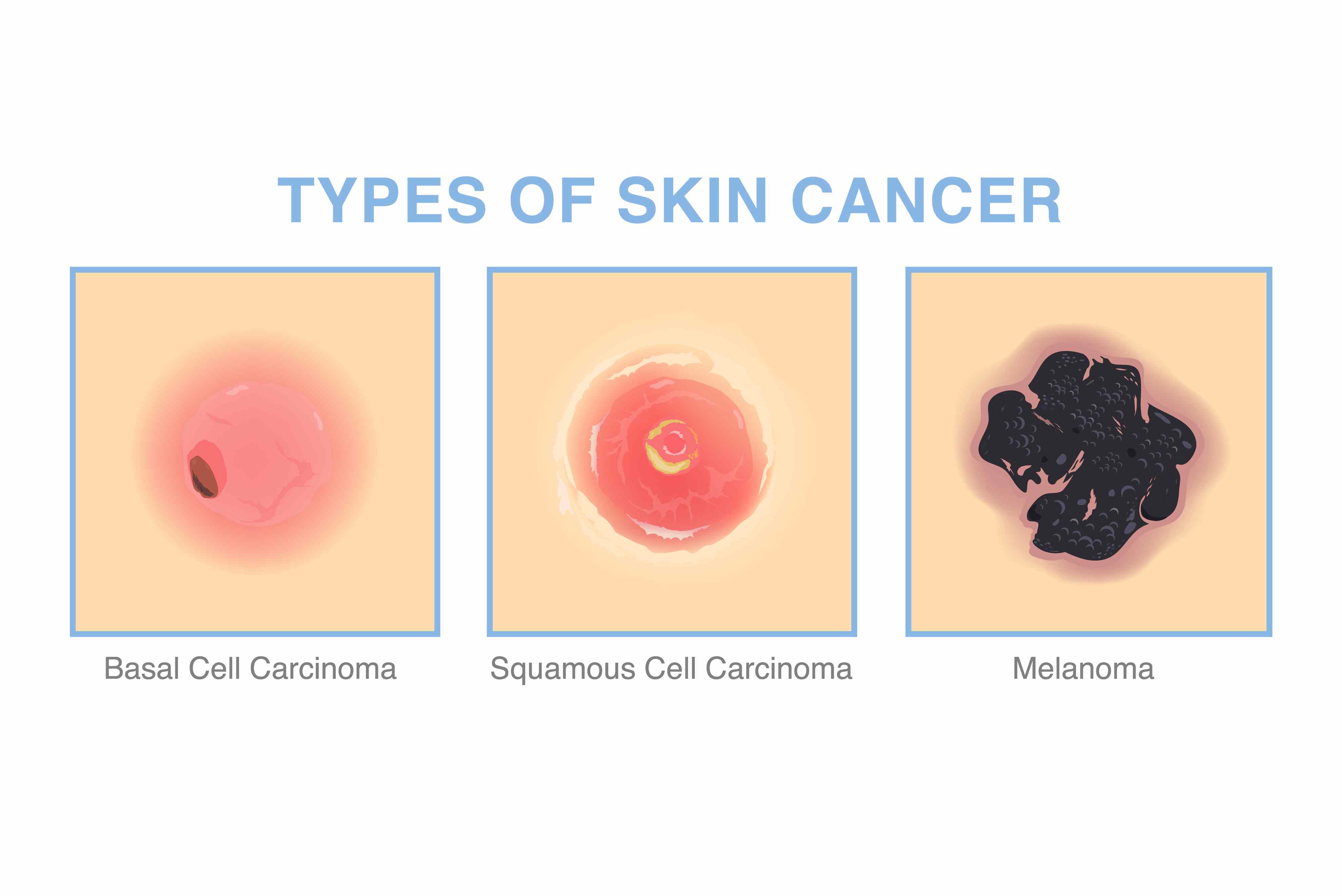 Stop Wasting Money: Of course, choose the right skin care products
