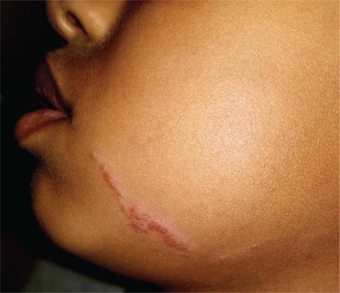 Scar Confidence: My Go-To Tricks for Flawless, Fearless Coverage