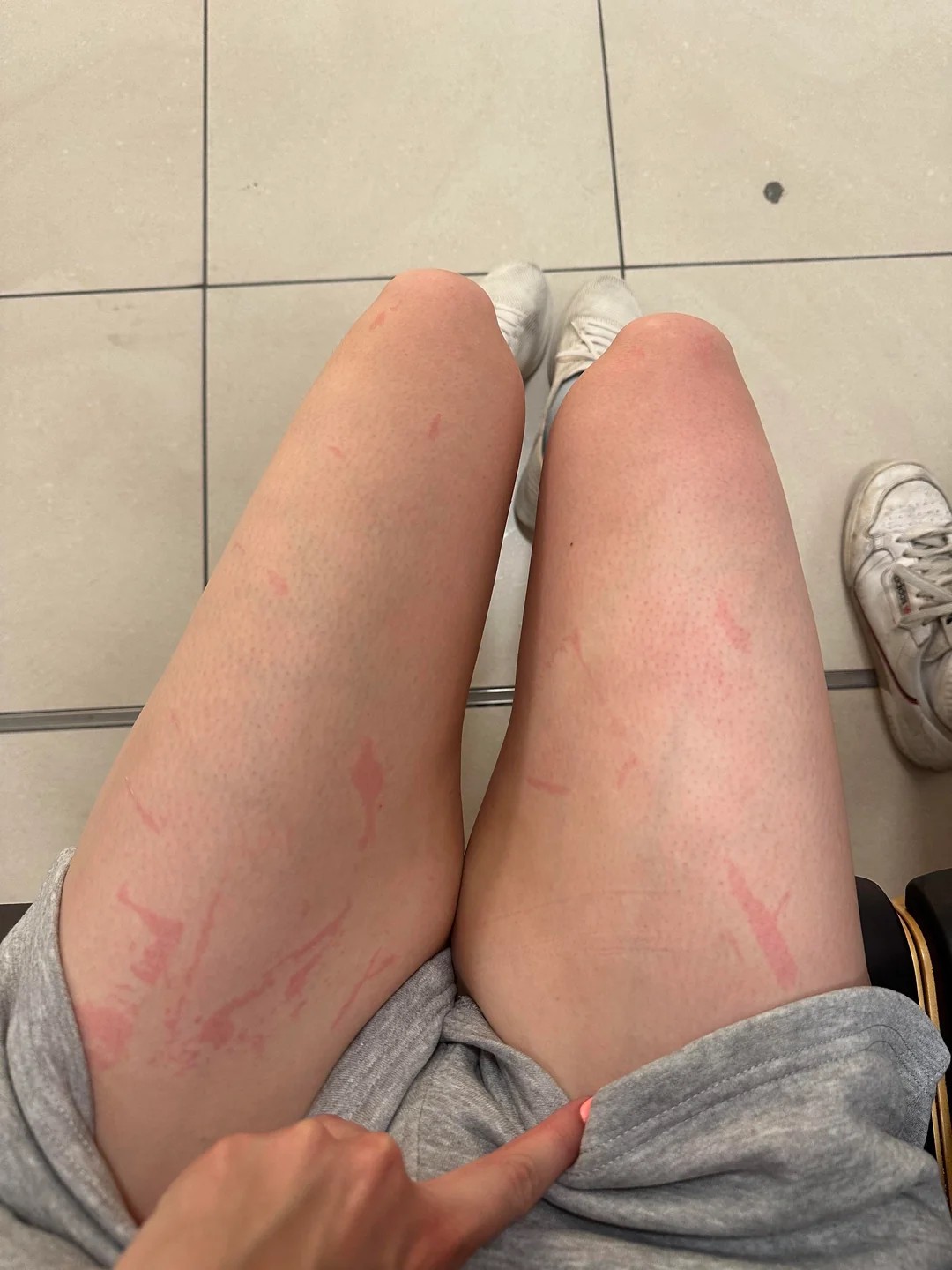 help! strange marks after waxing 🙀😭😭