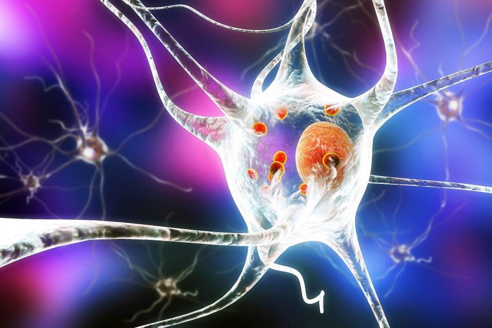 Cancer Drug’s Wild New Use: Parkinson’s!