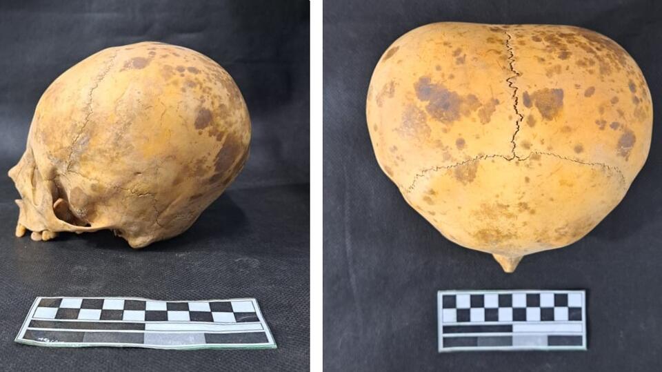 That 'Alien' Skull? Not What You Think!
