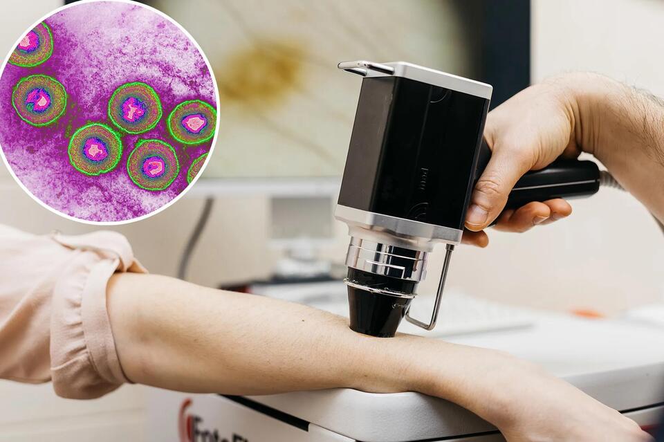 Herpes: The Unexpected Cancer Fighter?!