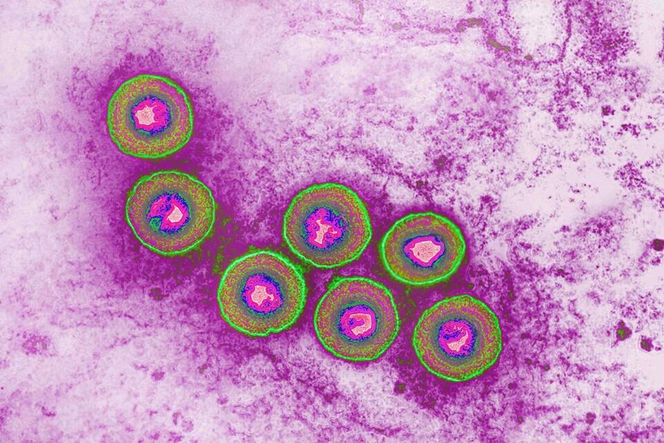 Herpes: The Unexpected Cancer Fighter?!