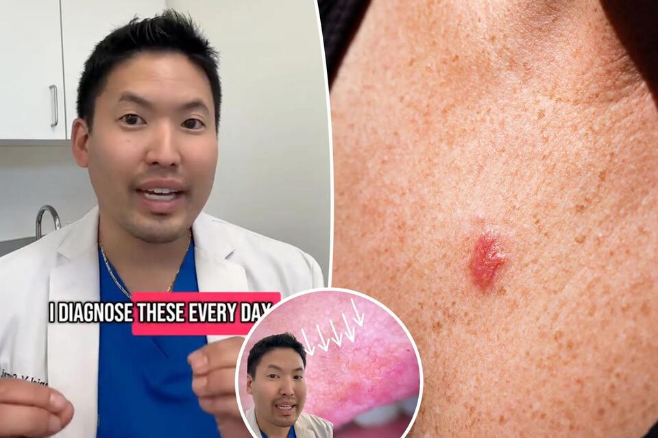 Herpes: The Unexpected Cancer Fighter?!