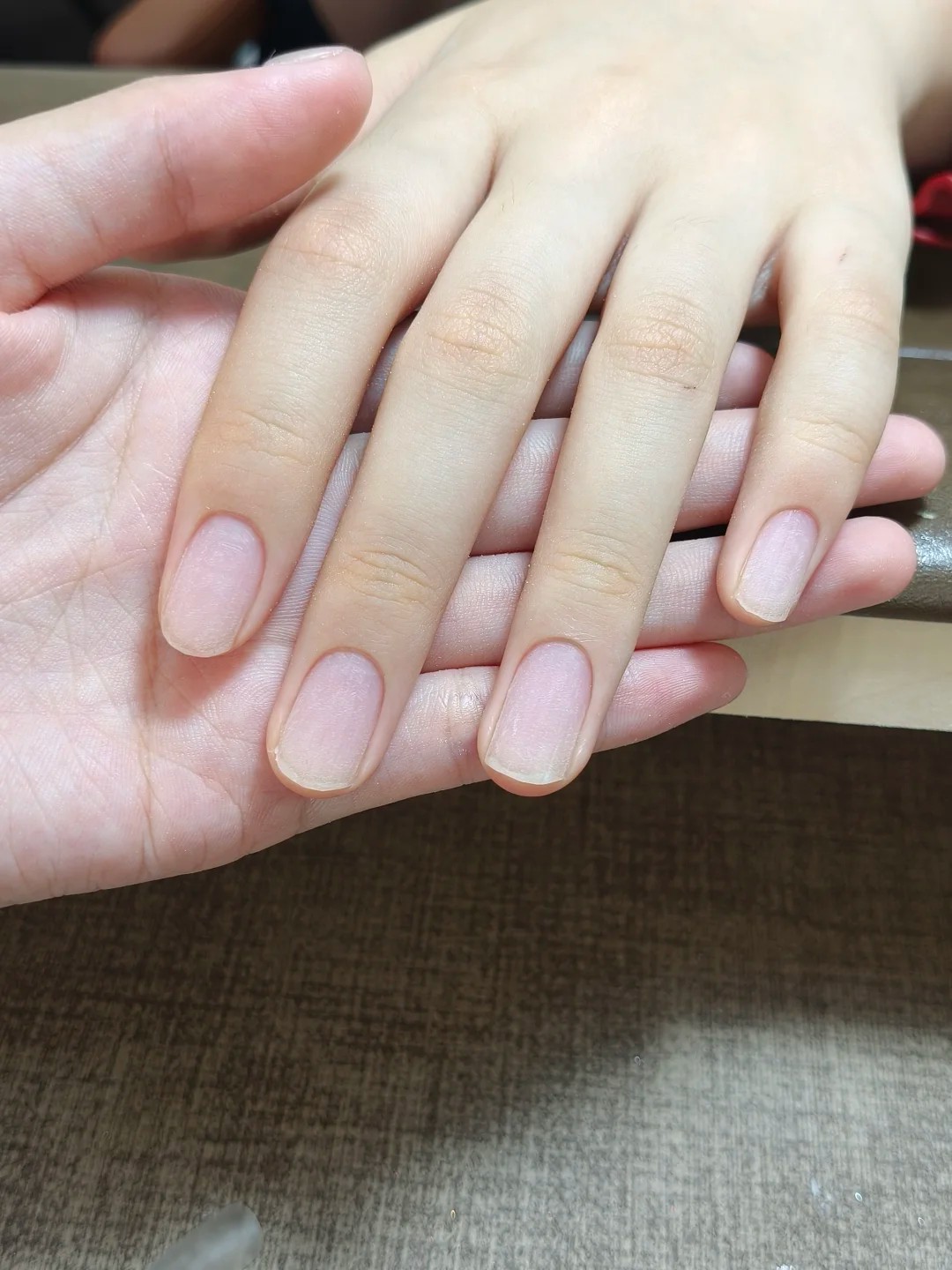 Why do my nails grow asymmetrically? 