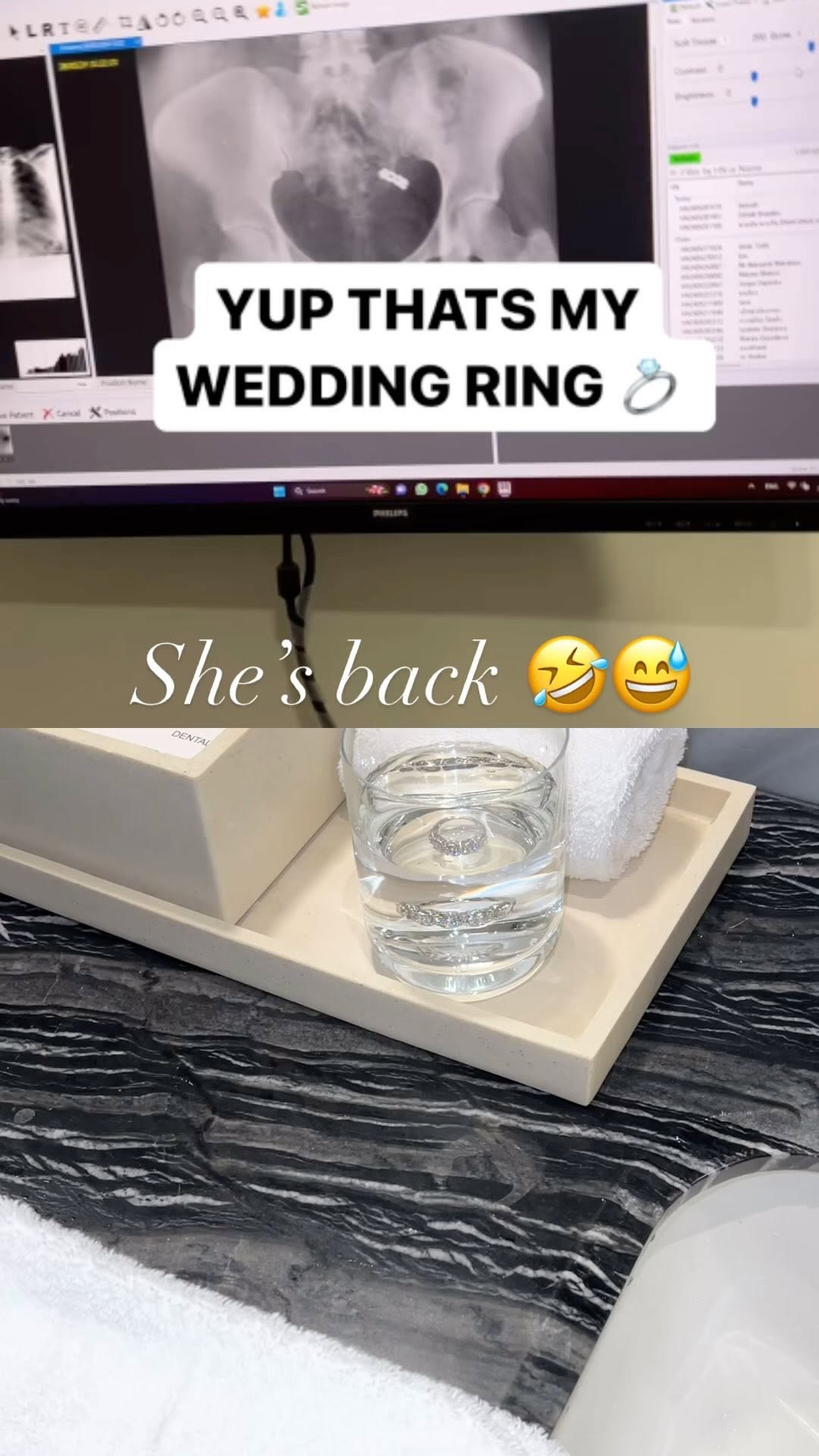 Jeweler Swallows Wedding Ring?!