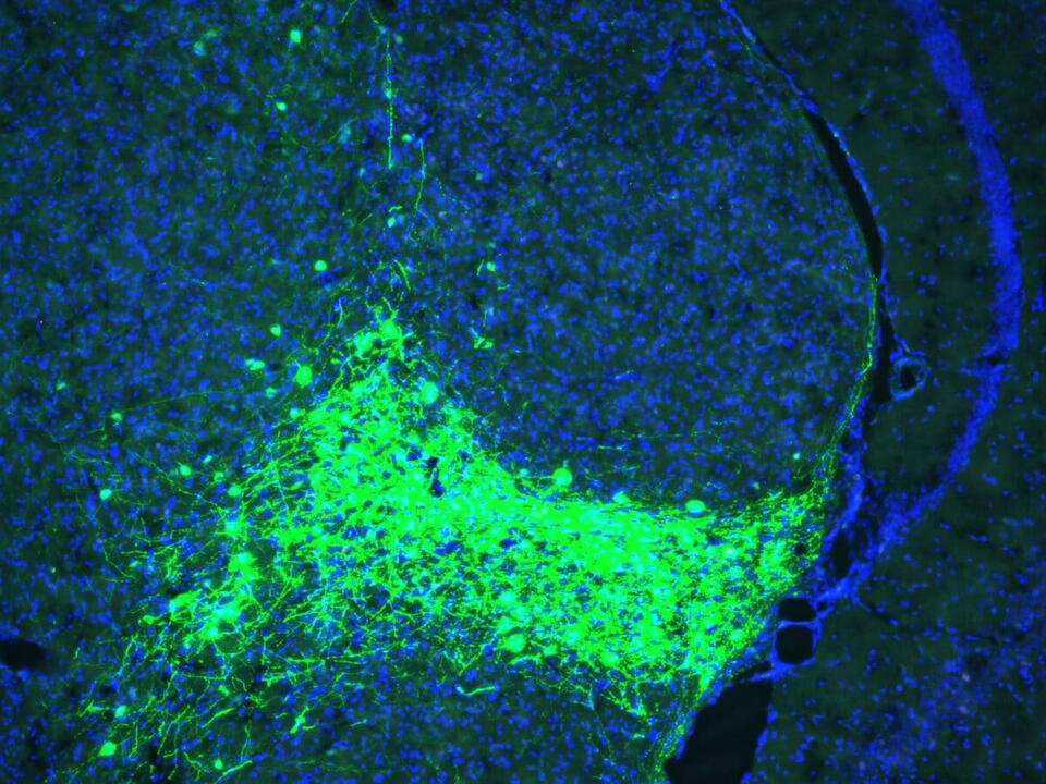Your Brain’s Secret Pain Alarm Exposed