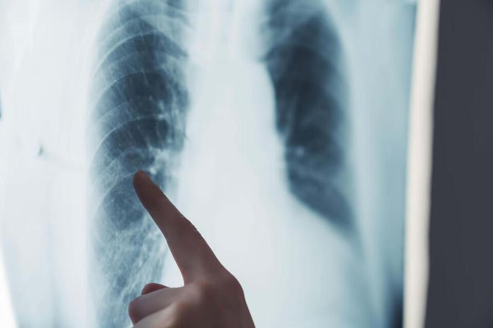 Radiographer Fired for Shocking Turban Comment