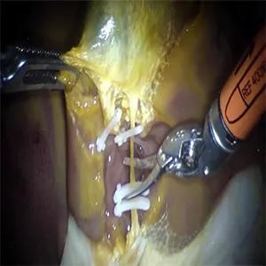 Would You Trust a Robot Surgeon?