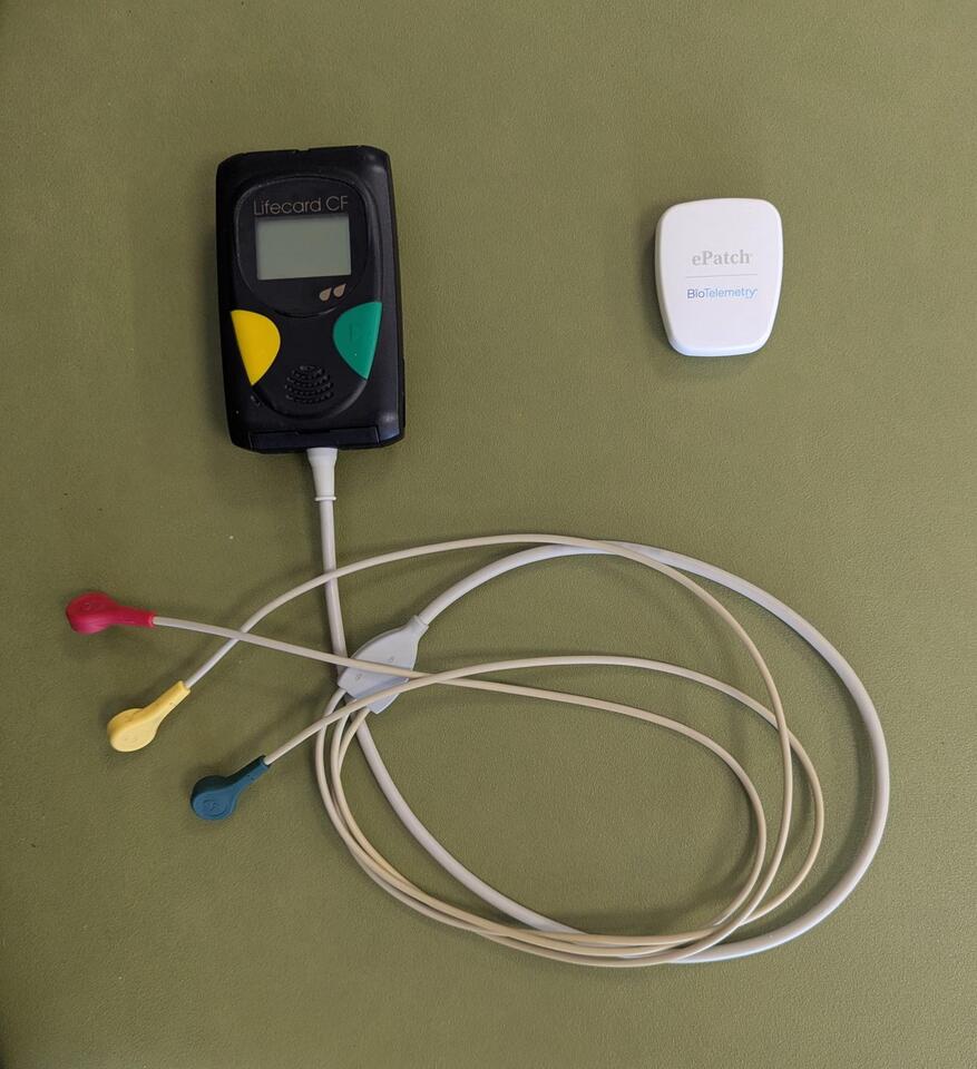 Would You Trust an AI Heart Monitor?