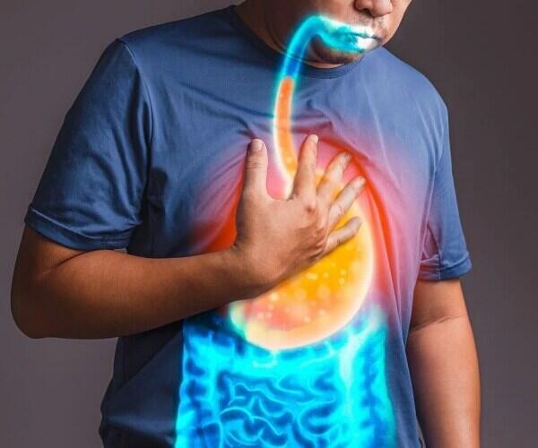 Ozempic & Acid Reflux? Here’s the Scoop