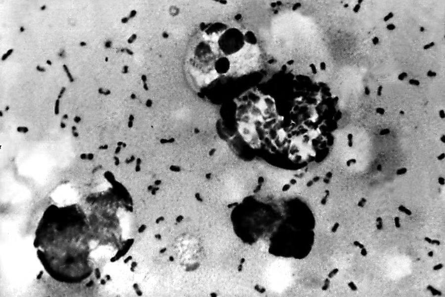 Plague in the US—Wait, That Still Happens?!