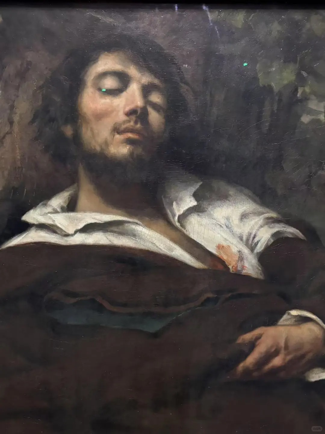 Wounded Man 