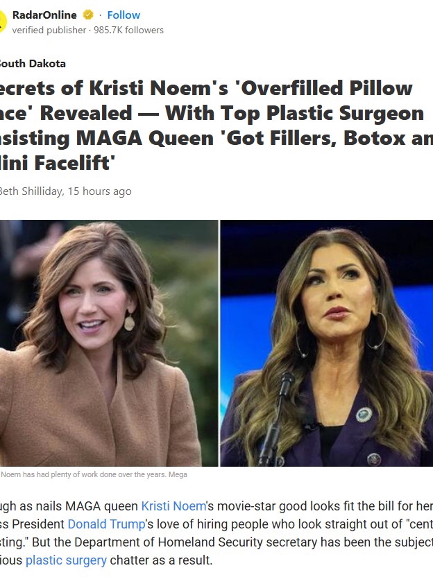 Kristi Noem’s Glow-Up: What’s Real?