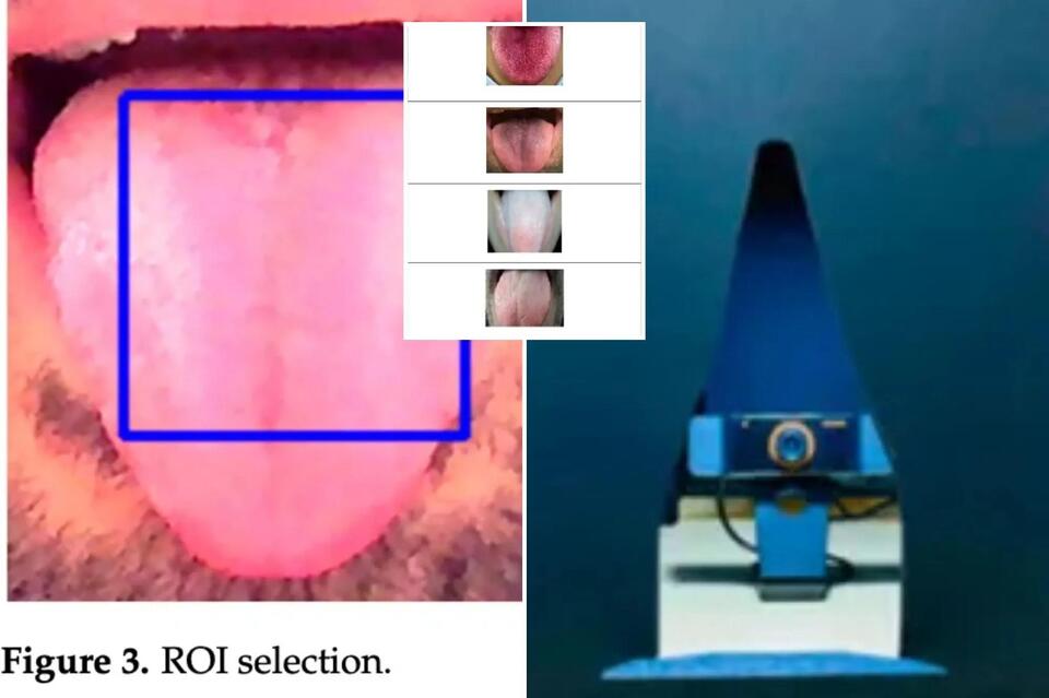 AI Outsmarts Docs at Spotting Hidden Heart Issues
