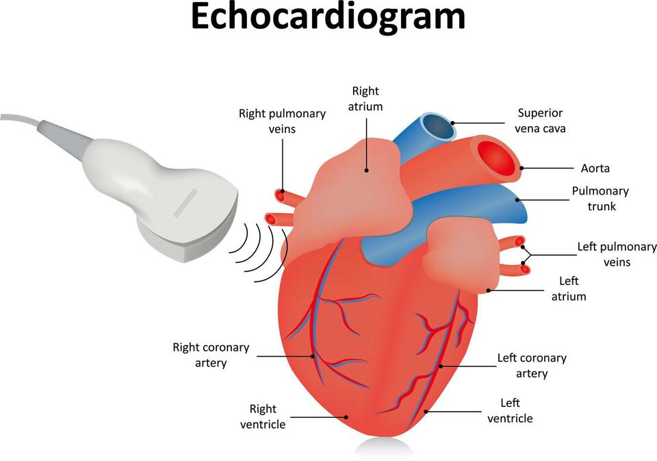 AI Outsmarts Docs at Spotting Hidden Heart Issues
