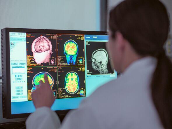 Is Hearing Loss in Your 30s a Dementia Clue?